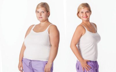 What are the Benefits of Bariatric Surgery?