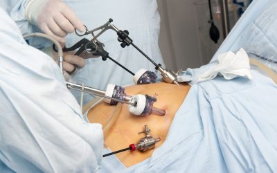 Is Robotic Bariatric Surgery Really Safer? What Patients Should Know